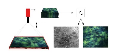 Depth of field extention and reconstruction of surface topography